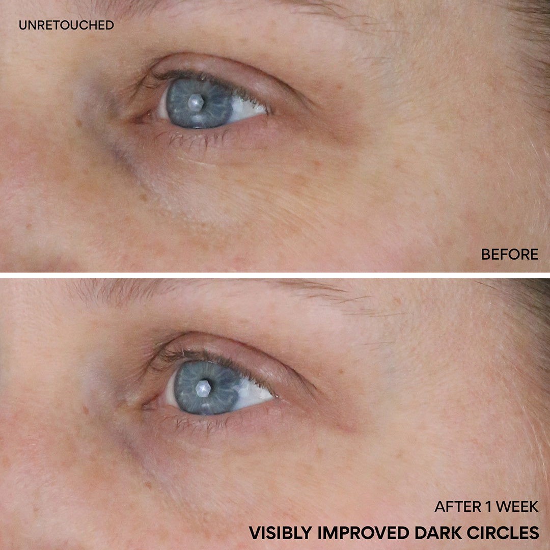 Vitamin C Niacinamide Brightening Eye Serum - Image 4
